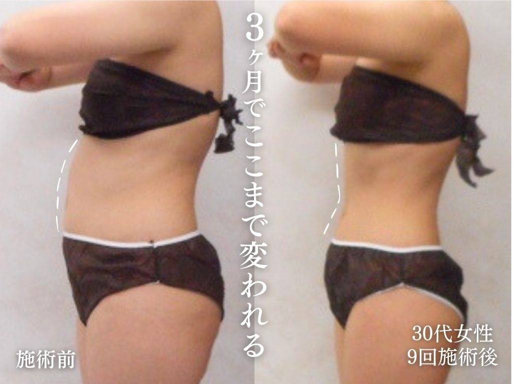 夏本番